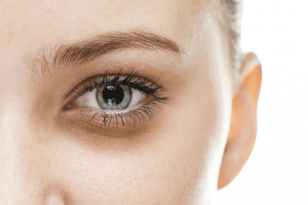 Thâm quầng mắt gây ảnh hưởng đến vẻ bề ngoài khiến chúng ta mất tự tin